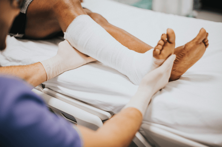Fracture Treatment